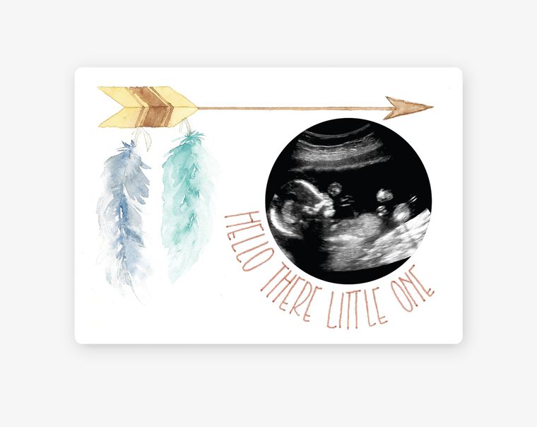 Feather Baby Magnetic Ultrasound Photo Frame - SuperMom Headquarters